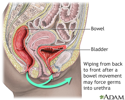 hiv and bladder infection