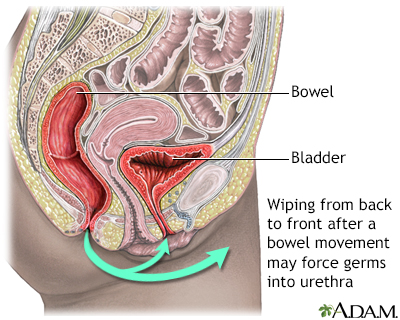 Urinary Tract Infection Uti Symptoms Causes And Treatment