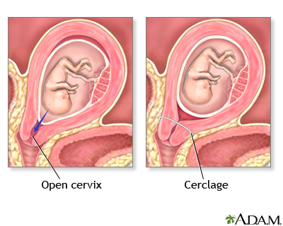 pregnancy 20 weeks