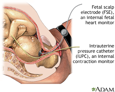 Procedures That May Take Place During Labor And Delivery